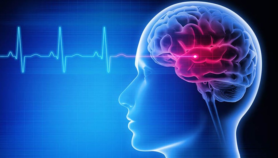 শীতকালে স্ট্রোকের ঝুঁকি বাড়ে যে কারণে