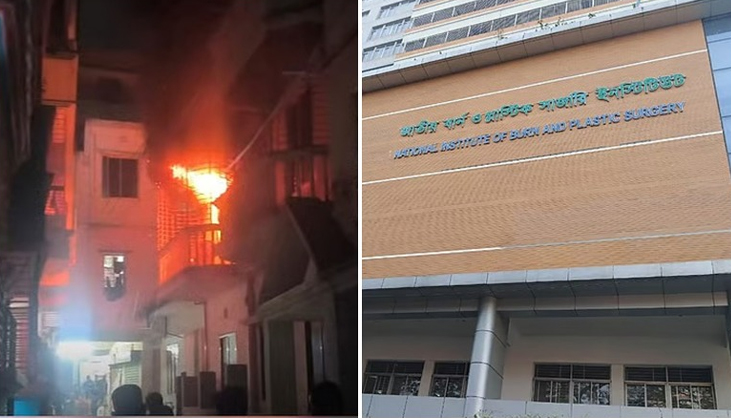 দুই ভাইয়ের ঝামেলা মেটাতে গিয়ে দগ্ধ ছাত্রদল নেতা