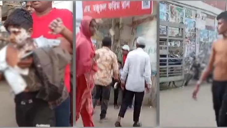 গণমিছিলে গ্যাস বেলুন বিস্ফোরণ, অর্ধশতাধিক দগ্ধ