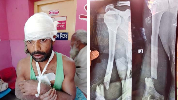 নোয়াখালীতে একজনকে কুপিয়ে জখম