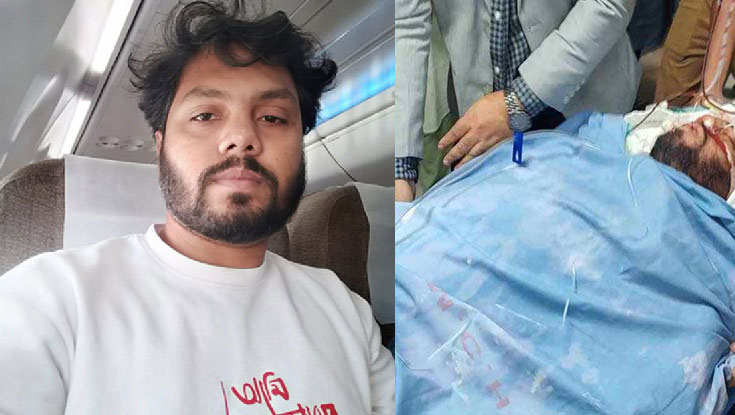 হাদির মাথার ভেতরে গুলি, চলছে অস্ত্রোপচার