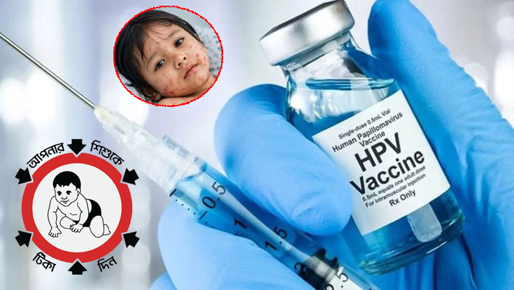 ঢাকাসহ ৪ সিটিতে হামের টিকা দেয়া হবে আজ