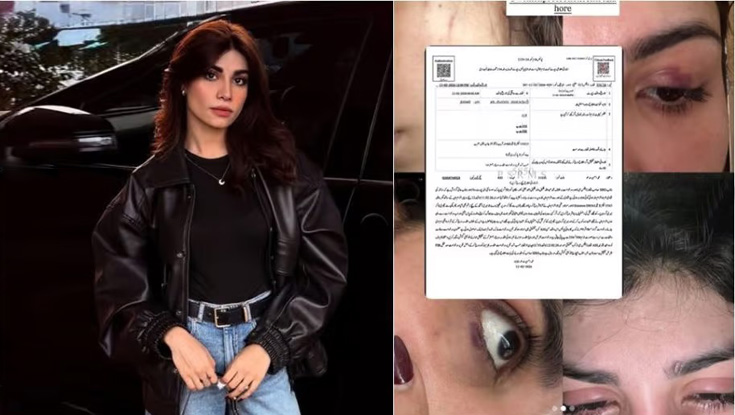 লজ্জা আর বয়ে বেড়াতে চান না ইকরা