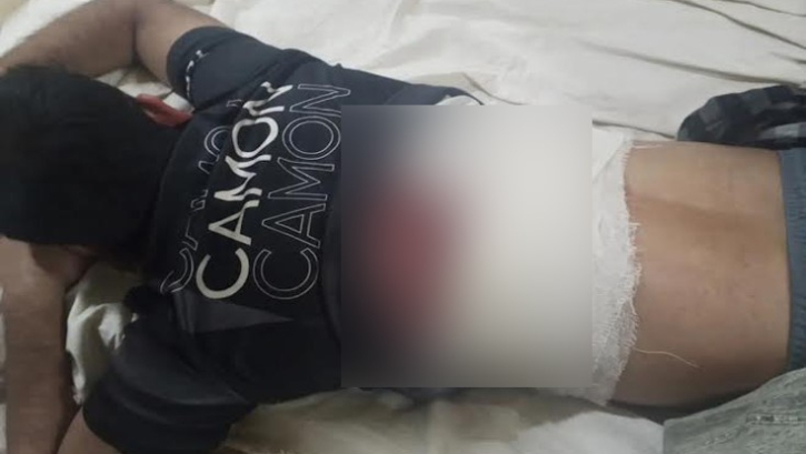 ব্যবসায়ীকে গুলি করে মোটরসাইকেল ছিনতাই