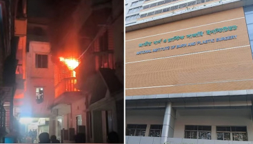 দুই ভাইয়ের ঝামেলা মেটাতে গিয়ে দগ্ধ ছাত্রদল নেতা