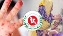 হাম উপসর্গে আরও তিন জনের মৃত্যু