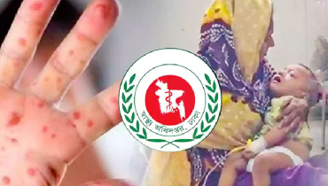 হাম উপসর্গে ৯ জনের মৃত্যু