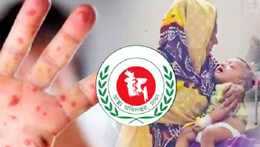 হাম উপসর্গে পাঁচজনের মৃত্যু