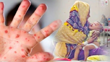 ২৪ ঘণ্টায় হামের উপসর্গে সাত জনের মৃত্যু ২৪ ঘণ্টায় হামের উপসর্গে সাত জনের মৃত্যু