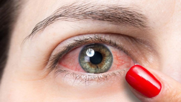 মাথায় আঘাত-চোখের মনি প্রসারণ: কী ও কেন ঘটে? মাথায় আঘাত-চোখের মনি প্রসারণ: কী ও কেন ঘটে?