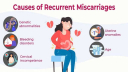 বারবার গর্ভপাতের কারণ-চিকিৎসা