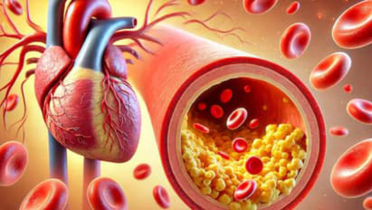 কোলেস্টেরল কেন বিপজ্জনক