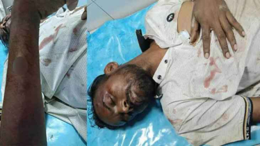 হিরো আলমের ওপর হামলা, অবস্থা আশঙ্কাজনক