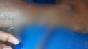 দলীয় কর্মীর রগ কাটলো ছাত্রদল