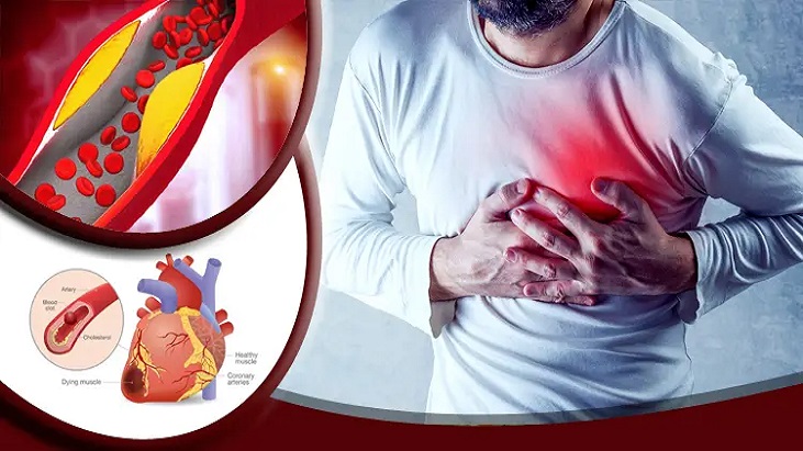 শীতকালে কোলেস্টেরল নিয়ন্ত্রণে রাখার উপায়