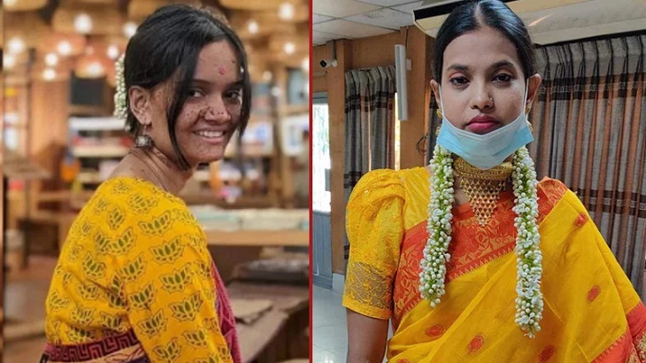 সারাহর কিডনি নেয়া শামীমা মারা গেছেন সারাহর কিডনি নেয়া শামীমা মারা গেছেন