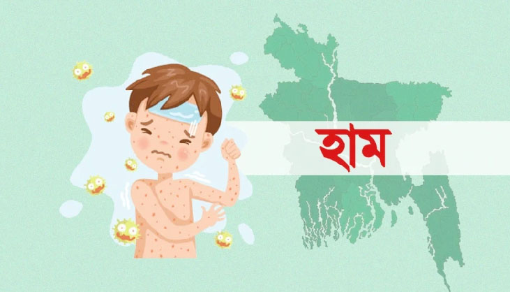 হাম উপসর্গ নিয়ে আরও ৭ শিশুর মৃত্যু