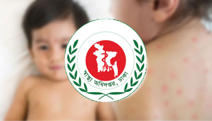 হাম উপসর্গ নিয়ে আরও ৭ শিশুর মৃত্যু