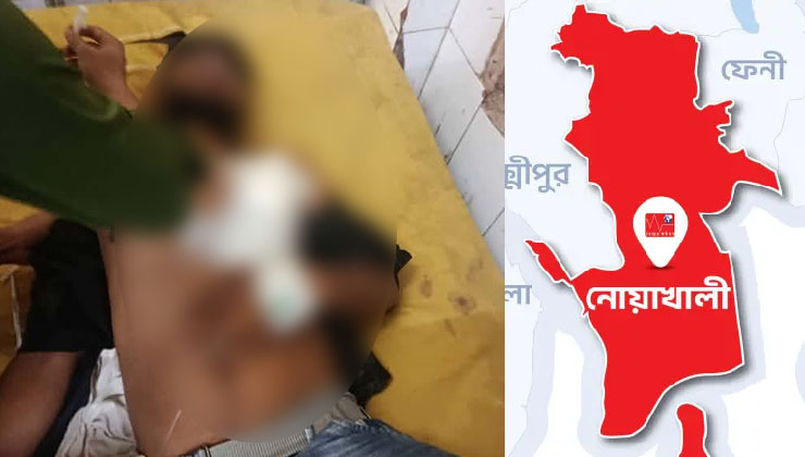 নোয়াখালীতে বিএনপি-জামায়াতের সংঘর্ষ, গুলিবিদ্ধ ১