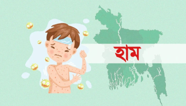 হাম উপসর্গে আরও ৬ শিশুর মৃত্যু