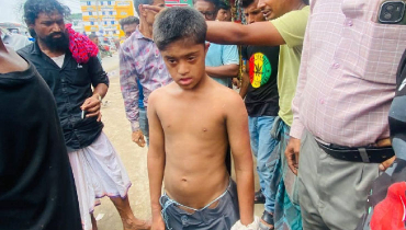 আম পাড়ার অপরাধে প্রতিবন্ধী শিশুকে অমানবিক নির্যাতন আম পাড়ার অপরাধে প্রতিবন্ধী শিশুকে অমানবিক নির্যাতন