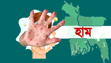 ২৪ ঘণ্টায় হাম সন্দেহে আট শিশুর মৃত্যু