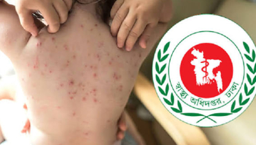 হামে চলতি বছর ১,১৯৬ শিশুর মৃত্যু