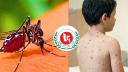 হাম-ডেঙ্গুতে ১০ জনের মৃত্যু হাম-ডেঙ্গুতে ১০ জনের মৃত্যু