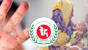 হামের উপসর্গে আরও আটজনের মৃত্যু