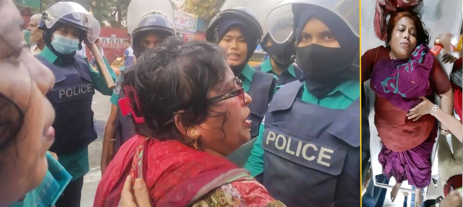 গ্রেনেড হামলায় আহত ফাতেমা। ফাইল ছবি- আপন দেশ